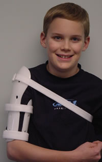 Humerus Fracture Brace